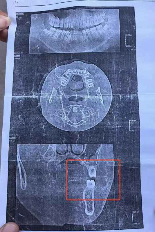  教育管理者：从校园安全事故看师德风险与制度防线 教育招生